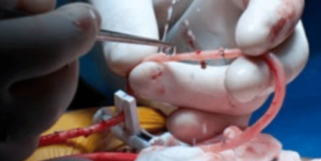 Teknolojinin geldiği son nokta! 3 boyutlu biyo-yazıcı ile yapay damar üretildi