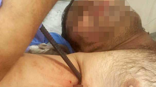 Hastaneye böyle getirildi! 3 santimle...