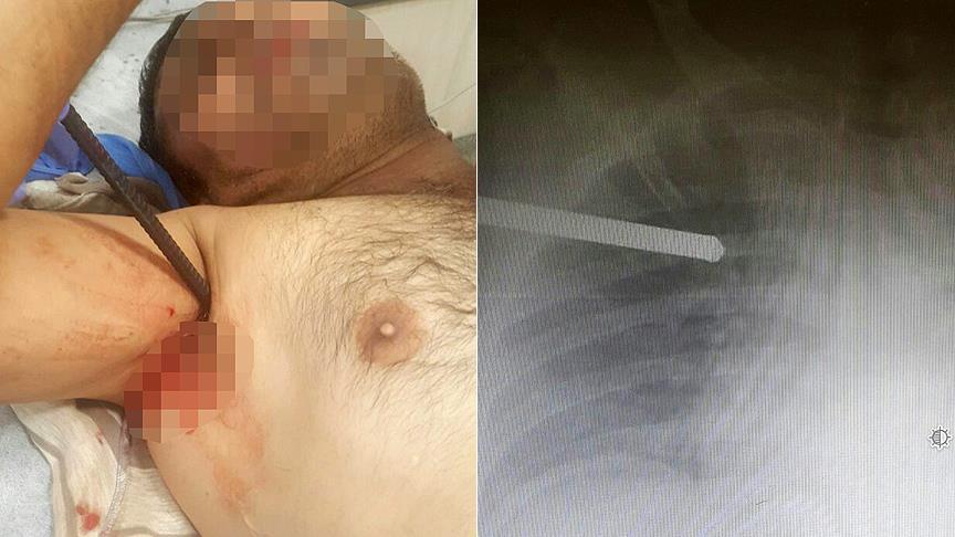 3 santimetreyle kurtuldu