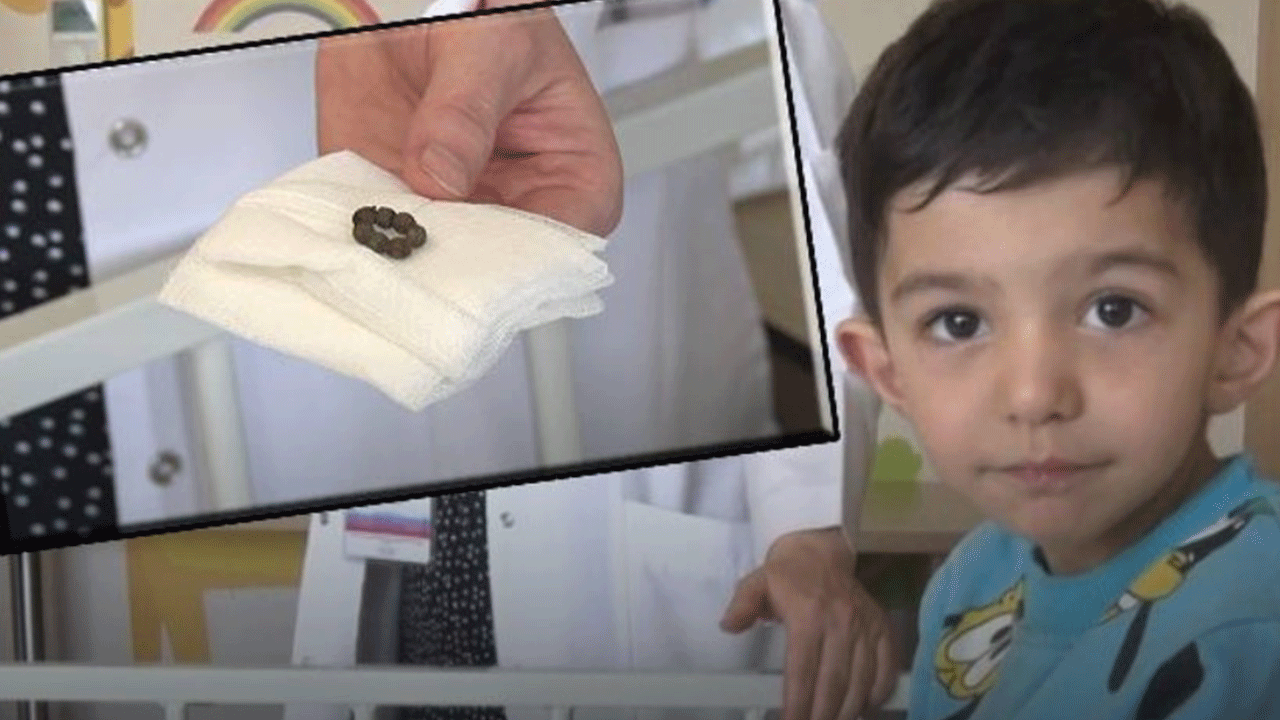 3 yaşındaki çocuğun bağırsağından 7 tane çıktı!