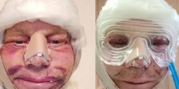 3 yıl boyunca gözlerini kapatamadı, çareyi Türkiye’de buldu