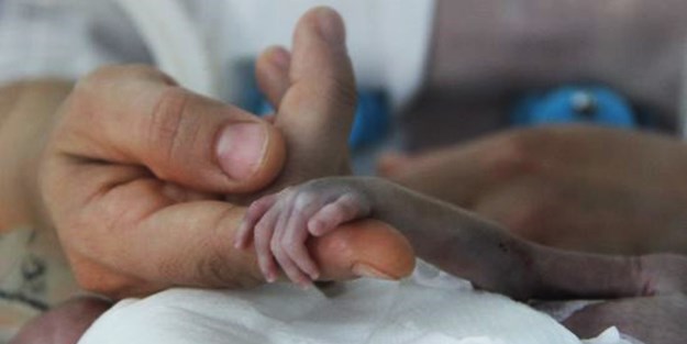 30 santimlik parmak bebek hayata tutundu