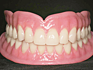 Uyumsuz diş protezinde kanser riski