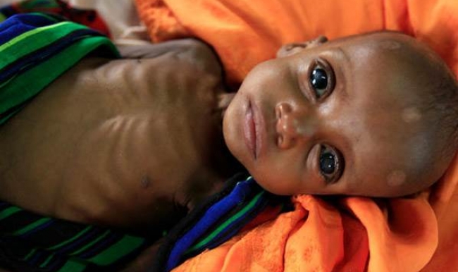 34 ülkenin halkına yetecek yiyeceği yok!