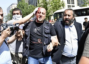 Gazeteci(!) Şık eylemlerin adamı