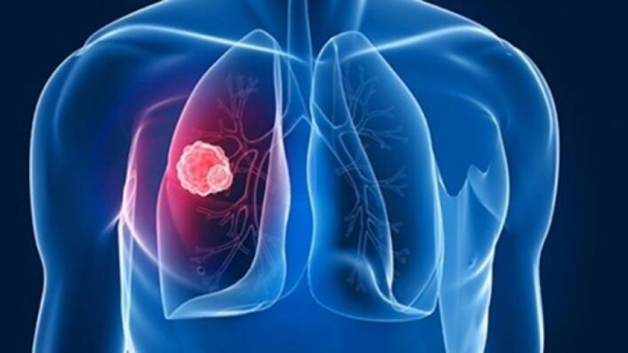 4 kişiden 1’inde bu hastalık görülüyor