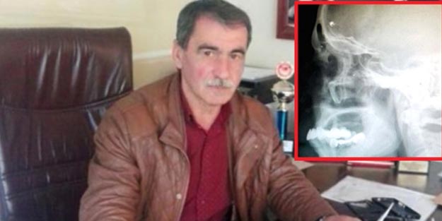 40 yıl önce askerde yüzünden vuruldu! 40 yıl sonra öyle bir soru sordu ki