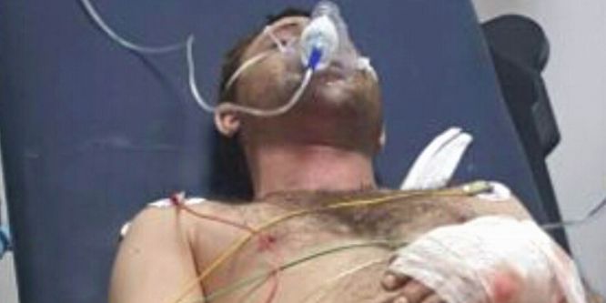 Tüp patladı: 1 yaralı