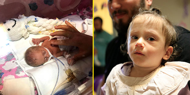 410 gram doğdu, 120 gün yaşam mücadelesi verdi... Şimdi 1 buçuk yaşında!