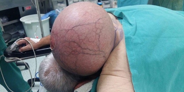 50 yıl başındaki bu 'kitle'yle yaşadı!