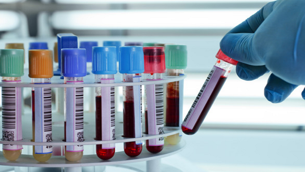 50'den Fazla Kanseri Tespit Eden Kan Testi Geliştirildi!