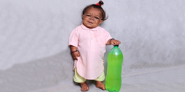 6 aylıkken gelişimi durdu, şimdi 21 yaşında