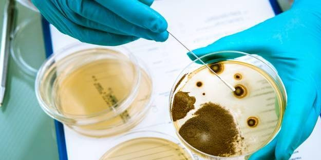 6 çeşit peynirde listeria bakterisi tespit edildi! Listeria nedir, belirtileri nelerdir?