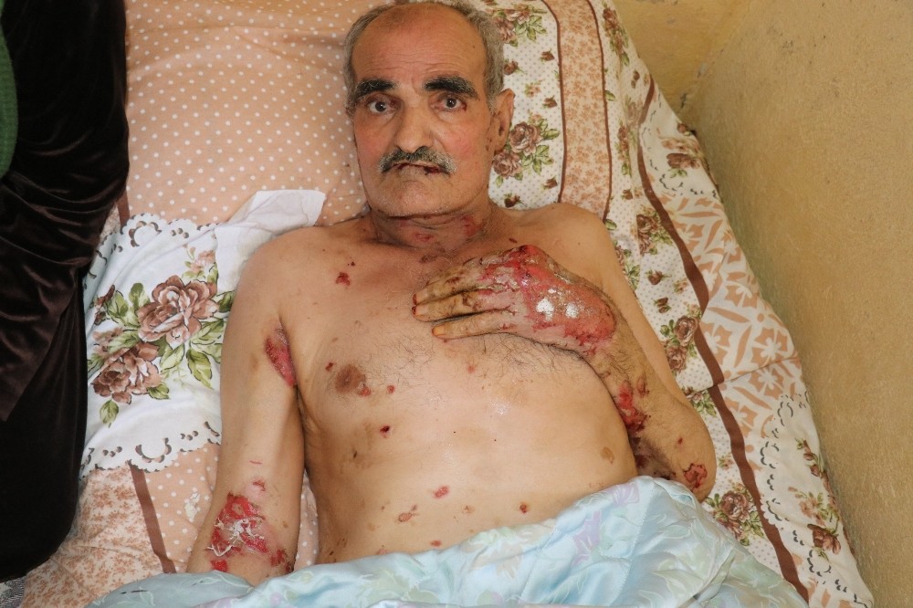 60 yaşında kabusu yaşıyor 