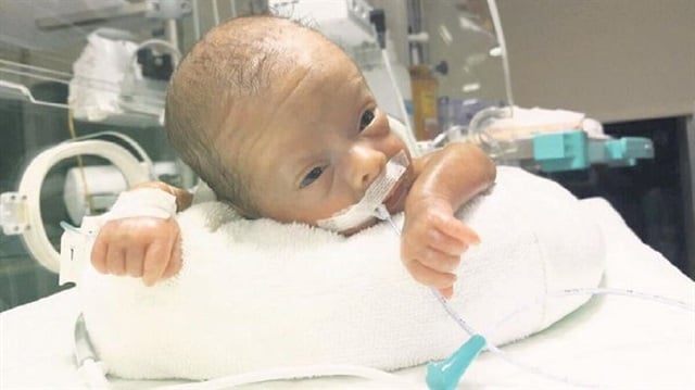 600 gram doğdu hayata tutundu