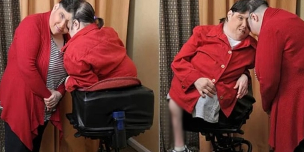 62 yıl birbirlerine başlarından yapışık olarak yaşadılar ve...