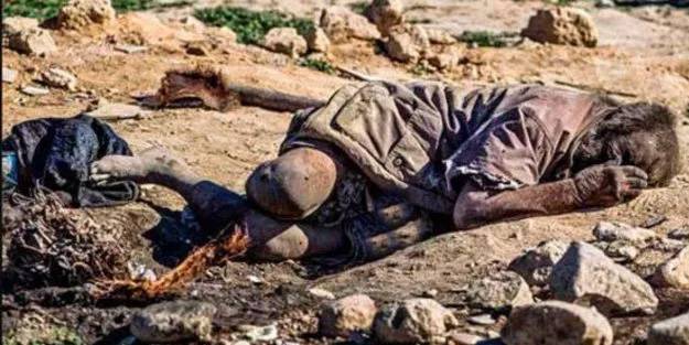 67 yıldır yıkanmayan 87 yaşındaki adam, bilim insanlarını şaşırttı