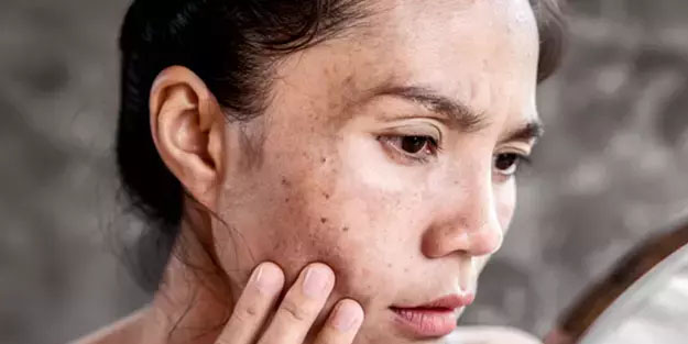 7 dakikada cilt tonunu eşitleyen tüyo: Öyle bir iyi geliyor ki!