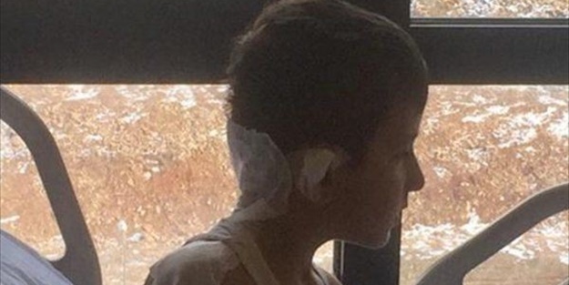 7 yaşındaki çocuğa 4 köpek saldırdı!