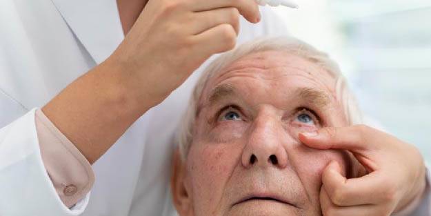 75 yaşın yüzde 20’sinde görülüyor, görme kaybına sebep olabilir