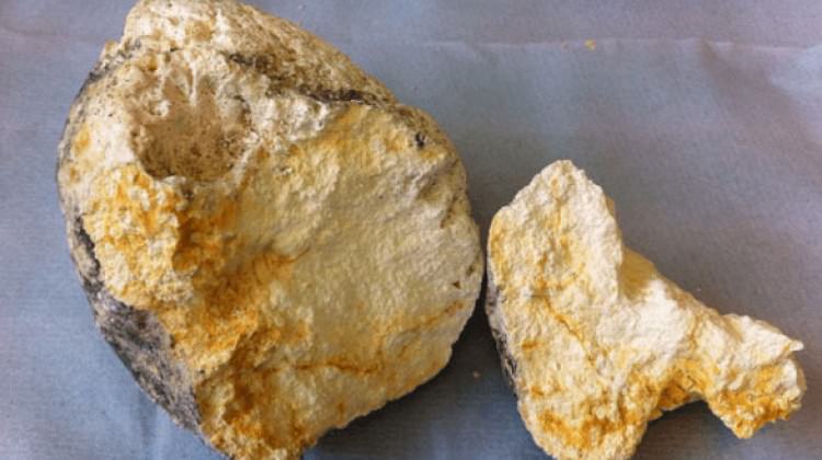 80 kilosuna 3 milyon dolar teklif ettiler