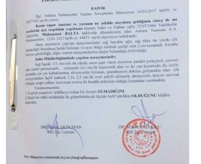 Adli Tıp ’AK Parti Trabzon Milletvekili Balta ısırıldı’ dedi