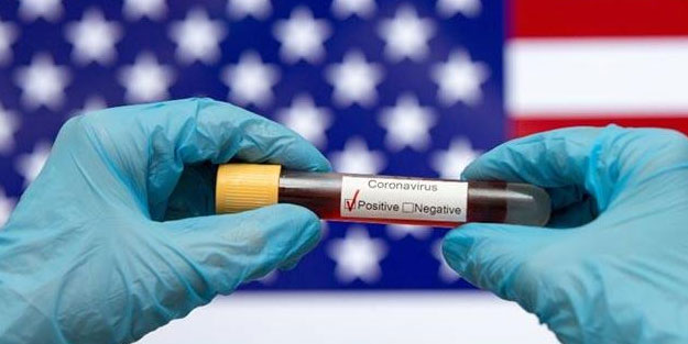 ABD koronavirüsle açıklanandan 2 ay daha erken karşılaşmış