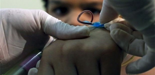 ABD ve Kanada'da Zika virüsü görüldü