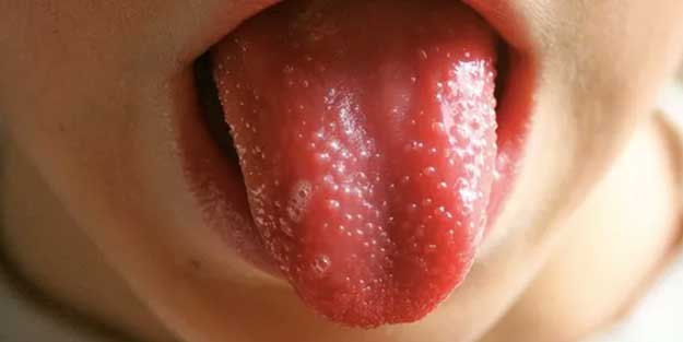 ABD’de 5 yaşındaki çocuğun ölümü dünyayı tedirgin etti: Bu ilk olabilir