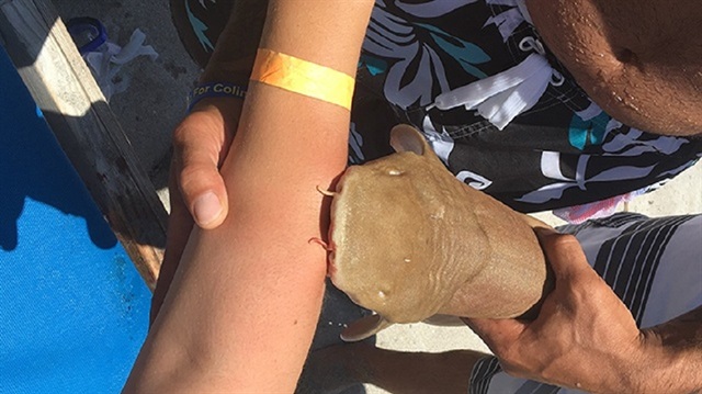 ABD'de hastaneye kolunu ısıran köpekbalığıyla götürüldü