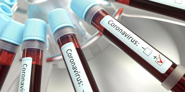 ABD'de korkutan koronavirüs rakamı! Yüzde 34 arttı