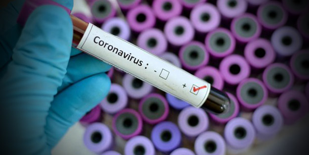 ABD'de koronavirüsten ölenlerin sayısı artıyor! Bazı eyaletlerde ilk ölümler gerçekleşti