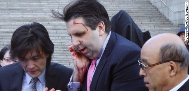 ABD'nin Seul Büyükelçisi'ne usturalı saldırının cezası belli oldu