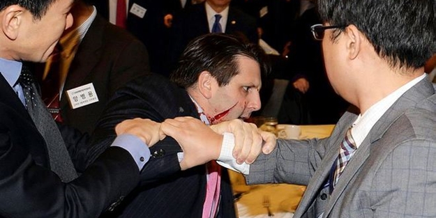 Büyükelçiye usturalı saldırı!