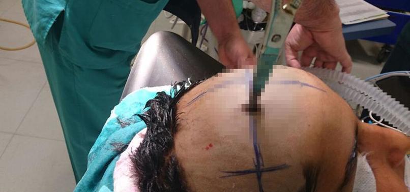 Abisinin attığı makas kafasına saplandı