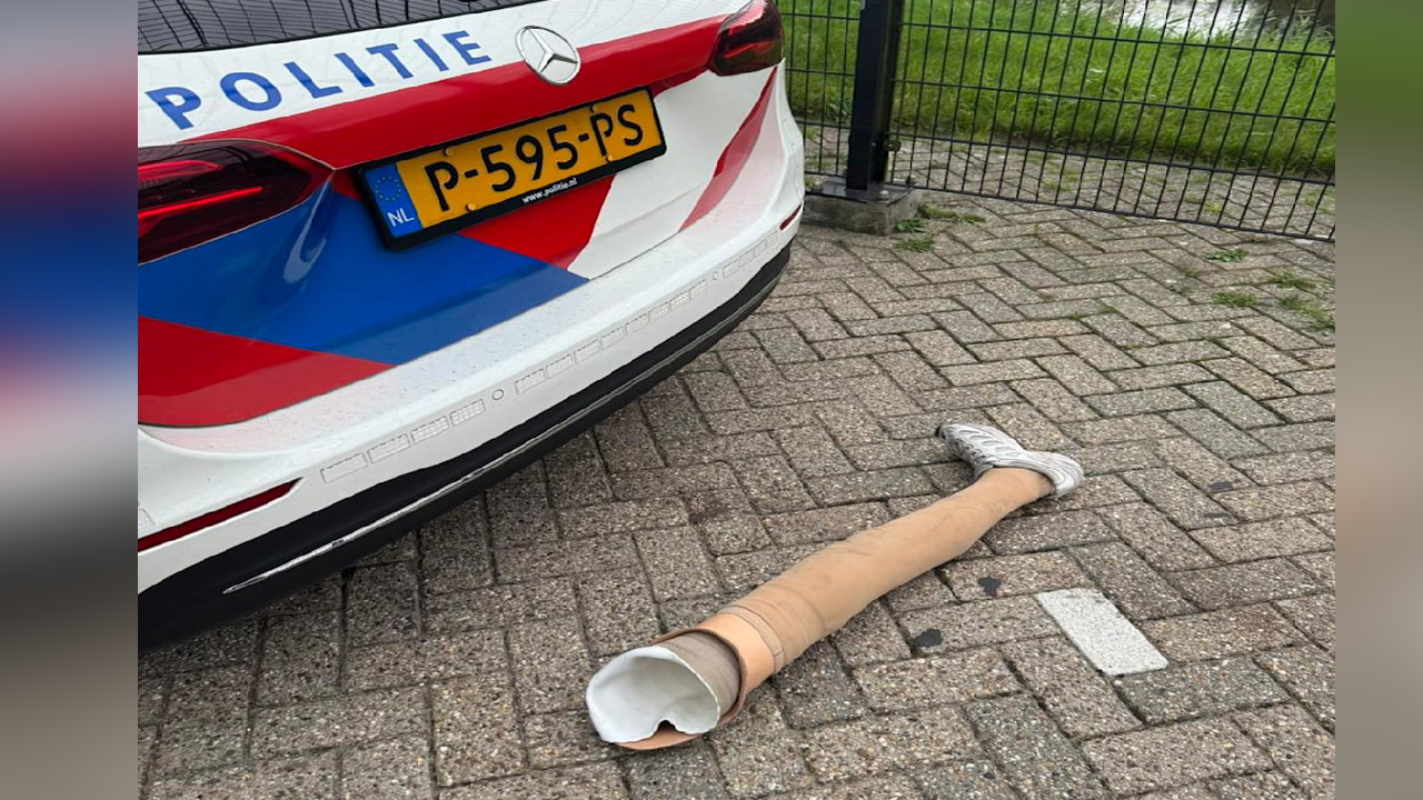 Acemi hırsız kaçarken bacağını düşürdü