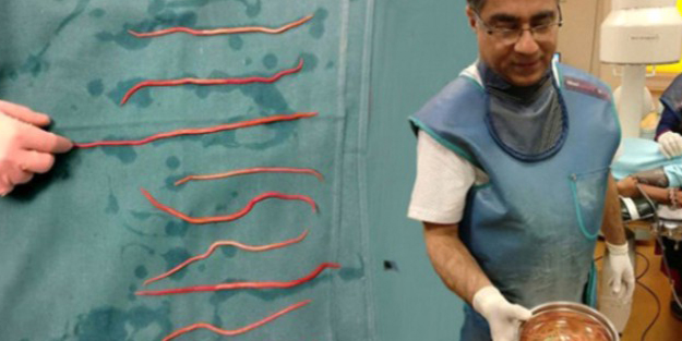 Acı yüzünden hastaneye gitti şok oldu! Vücudundan öyle bir şey çıktı ki