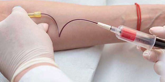 Acil 0 Rh Negatif kan aranıyor