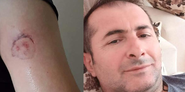Acil serviste olay: Sağlık memurunı ısırdı!