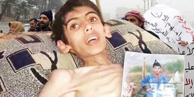 Açlığın şehri Madaya nasıl bu hale geldi?