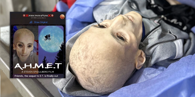 Açlıktan ölen Gazzeli çocukla dalga geçtiler! 'Uzaylı'