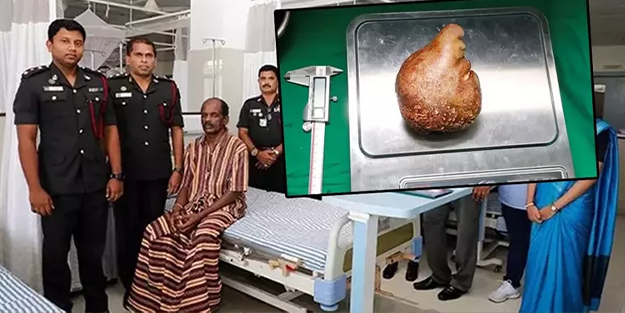 Adamın içinden çıktı! Doktorları bile şaşırtan dünya rekoru