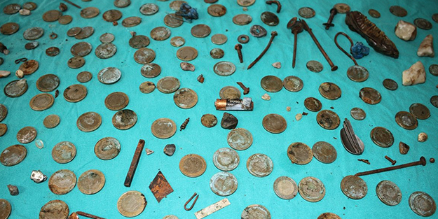 Adamın midesinden çıkanlar şoke etti!