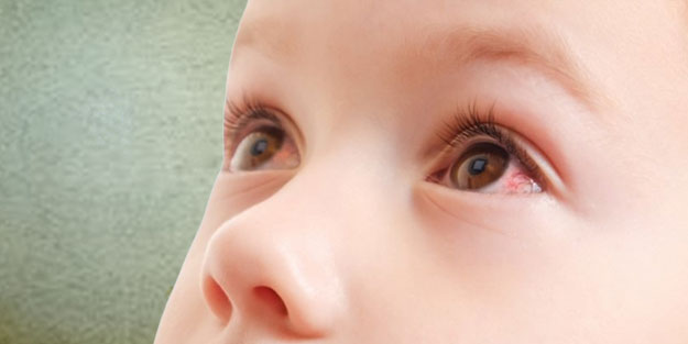 Adenovirus nedir? Adenovirus belirtileri neler nasıl bulaşır?