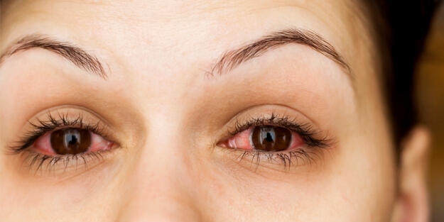 Adenovirüs paniği! Kovid-19 kadar hızlı yayılıyor