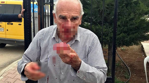 Adıyaman'da iki kardeş, müdür yardımcısının burnunu kırdı