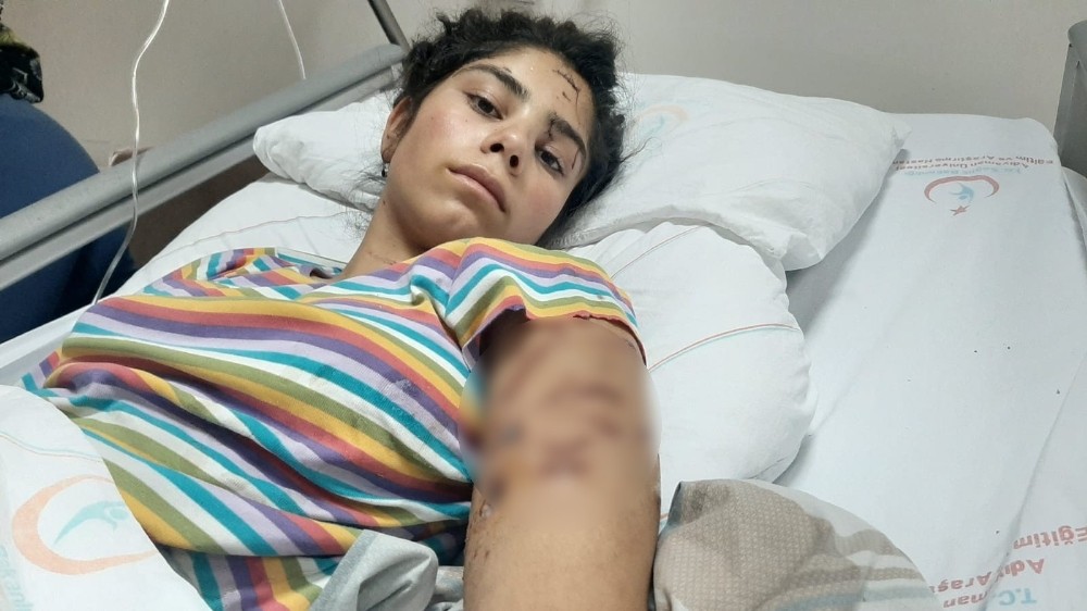 Adıyaman’da köpek dehşeti 