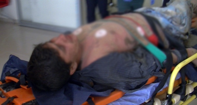 Adıyaman'da suya atlarken başına öyle bir şey geldi ki...