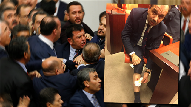 Adli Tıp'ın 'ısırık raporu' ortaya çıktı!