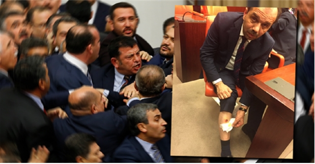 Adli Tıp'tan 'Isırık' raporu!